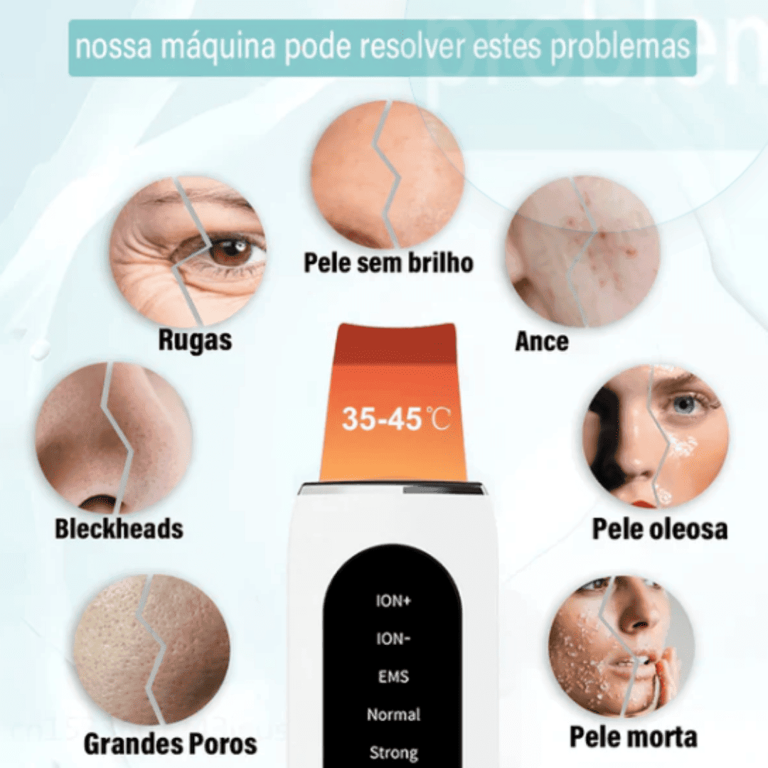 Esfoliador Ultrassônico de Pele da DermaSonic™ Removedor de Cravos e Limpador Facial com Cavitação | Loja Bosque